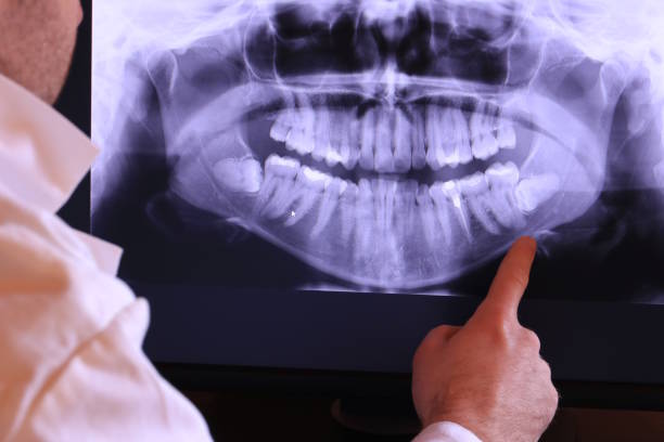 Best Urgent Tooth Repair  in Oakbrook Terrace, IL